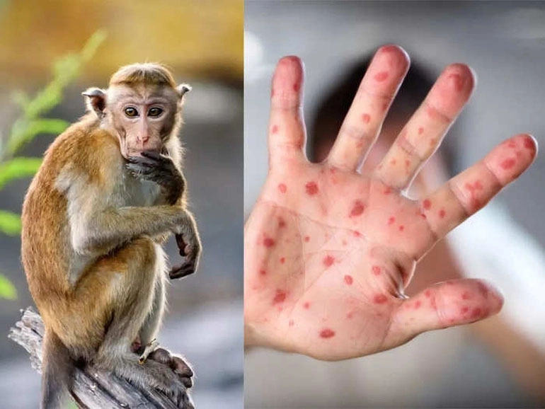 Nghệ An: Chủ động phòng ngừa bệnh Đậu mùa khỉ và dịch bệnh trên đàn vật nuôi